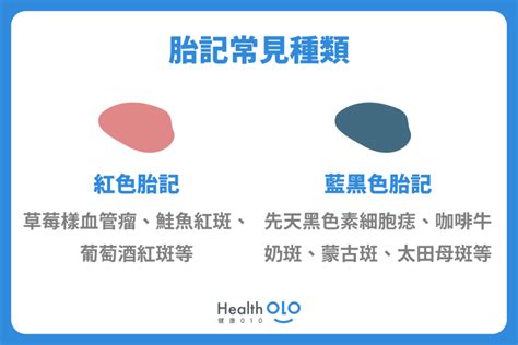 胎記 手臂|胎記怎麼產生、何時消除？醫師剖析胎記種類、胎記寓意